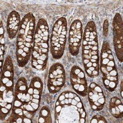 Immunohistochemistry-Paraffin: INPP4B Antibody [NBP1-86272]