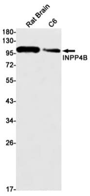 Western Blot: INPP4B Antibody (S08-7C7) [NBP3-19665]