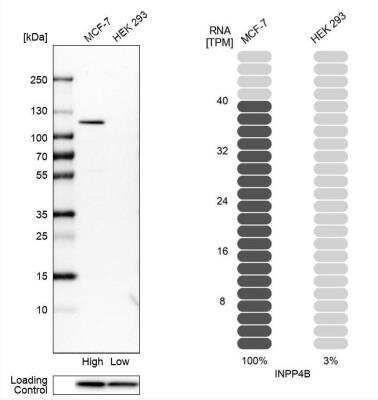 Western Blot: INPP4B Antibody [NBP1-85883]