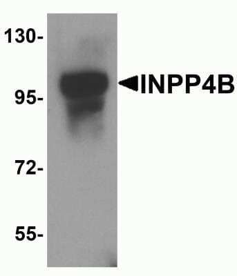 Western Blot: INPP4B AntibodyBSA Free [NBP2-82096]