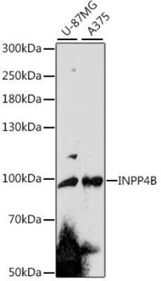 Western Blot: INPP4B AntibodyAzide and BSA Free [NBP3-05003]