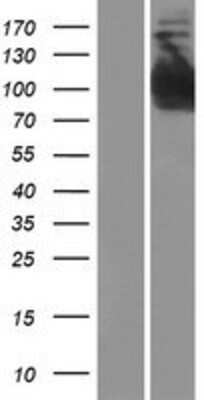 Western Blot: INPP4B Overexpression Lysate [NBP2-08265]