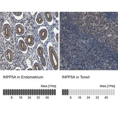 Immunohistochemistry-Paraffin: INPP5A Antibody [NBP1-89361]