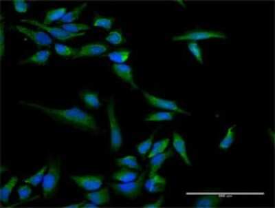 Immunocytochemistry/ Immunofluorescence: INPP5B Antibody [H00003633-D01P]