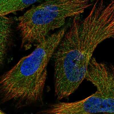 Immunocytochemistry/ Immunofluorescence: INPP5B Antibody [NBP1-89439]