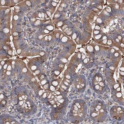 Immunohistochemistry-Paraffin: INPP5B Antibody [NBP1-89439]
