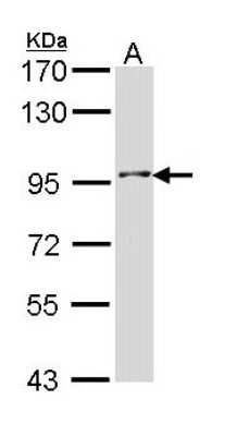 Western Blot: INPP5B Antibody [NBP1-31705]