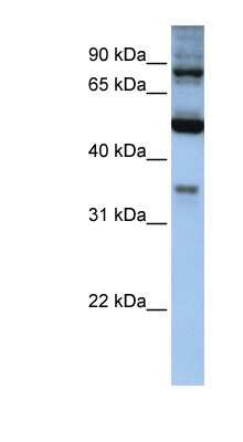 Western Blot: INPP5B Antibody [NBP1-54719]