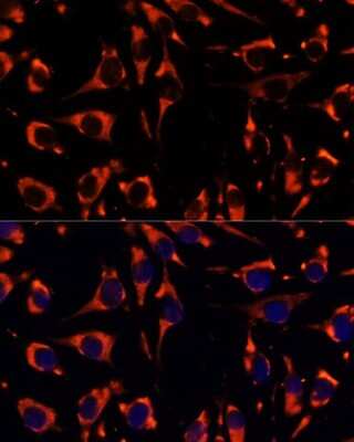 Immunocytochemistry/ Immunofluorescence: INPP5E Antibody - Azide and BSA Free [NBP3-05081]