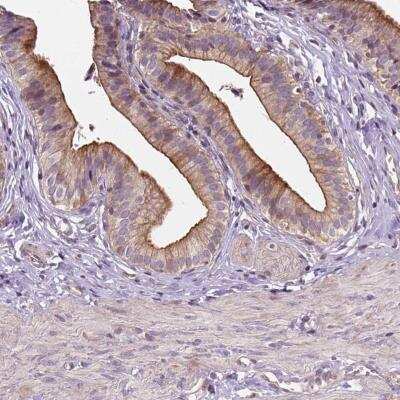 Immunohistochemistry-Paraffin: INPP5E Antibody [NBP2-49463]