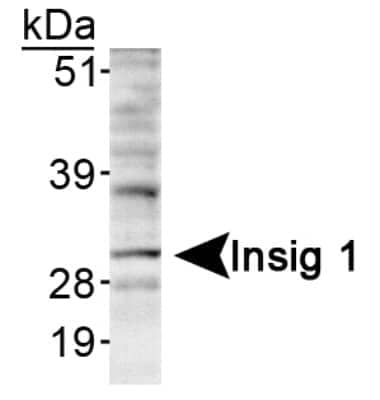 Western Blot: INSIG-1 AntibodyBSA Free [NB110-55244]