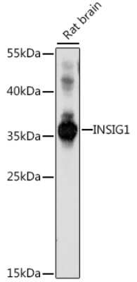 Western Blot: INSIG-1 AntibodyAzide and BSA Free [NBP3-02969]