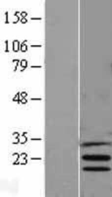 Western Blot: INSIG-1 Overexpression Lysate [NBL1-12003]