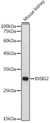 Western Blot: INSIG-2 AntibodyAzide and BSA Free [NBP3-03000]