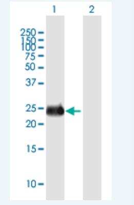 Western Blot: INSIGF Antibody [H00723961-B01P-50ug]