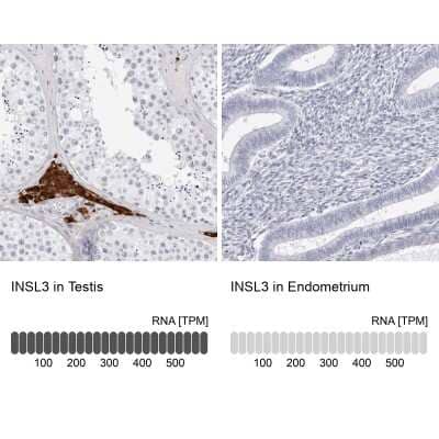 Immunohistochemistry-Paraffin: INSL3 Antibody [NBP1-81223]