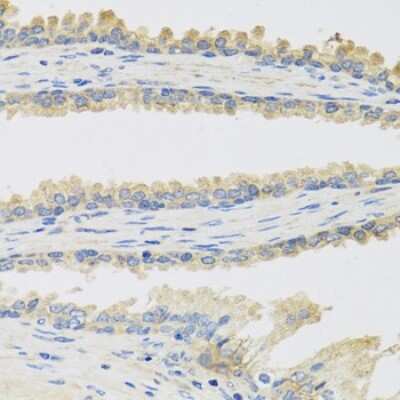 Immunohistochemistry-Paraffin: INSL3 Antibody - BSA Free [NBP3-04435]