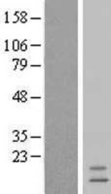 Western Blot: INSL3 Overexpression Lysate [NBL1-12005]