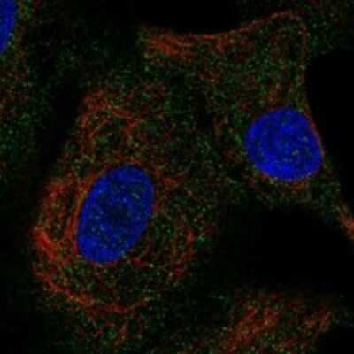 Immunocytochemistry/ Immunofluorescence: INSL4 Antibody [NBP3-17385]