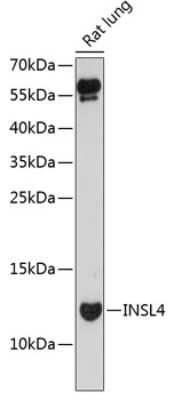 Western Blot: INSL4 AntibodyAzide and BSA Free [NBP3-04443]