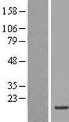 Western Blot: INSL5 Overexpression Lysate [NBL1-12007]