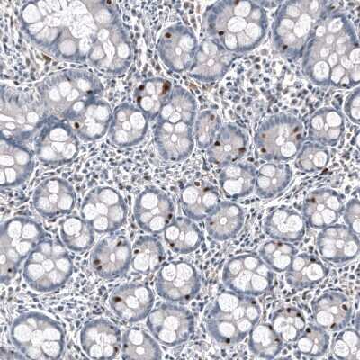 Immunohistochemistry-Paraffin: INSM1 Antibody (CL11630) [NBP3-15120]