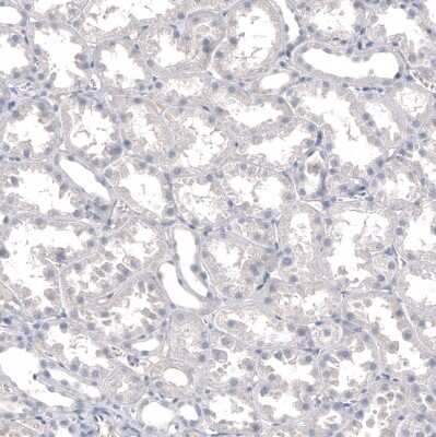 Immunohistochemistry-Paraffin: INSM1 Antibody (CL11630) [NBP3-15120]