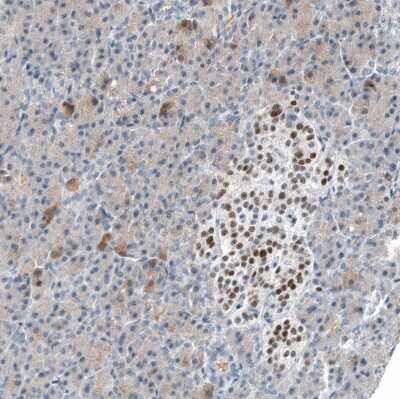 Immunohistochemistry-Paraffin: INSM1 Antibody (CL11630) [NBP3-15120]