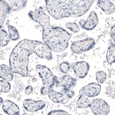 Immunohistochemistry-Paraffin: INSM1 Antibody (CL11630) [NBP3-15120]