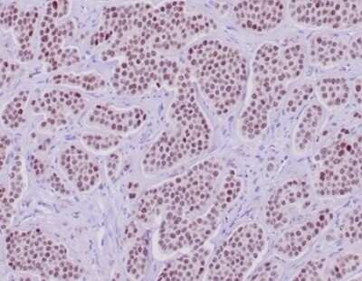 Immunohistochemistry-Paraffin: INSM1 Antibody (INSM1/6286R) [NBP3-13953]