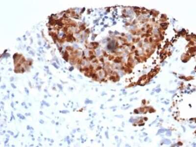 Immunohistochemistry-Paraffin: INSM1 Antibody (INSM1/6286R) [NBP3-13953]
