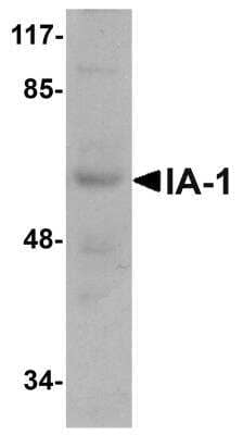 Western Blot: INSM1 AntibodyBSA Free [NBP1-76307]