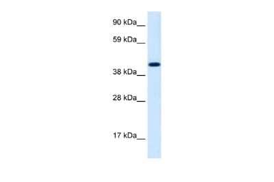 Western Blot: INSM1 Antibody [NBP2-84096]