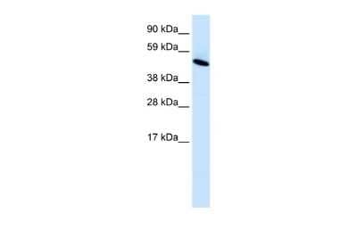 Western Blot: INSM1 Antibody [NBP2-84097]