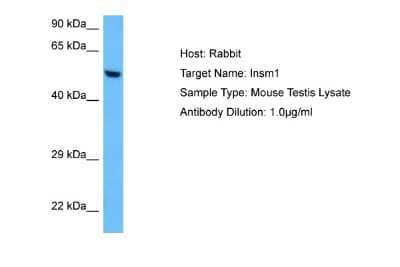 Western Blot: INSM1 Antibody [NBP2-84098]