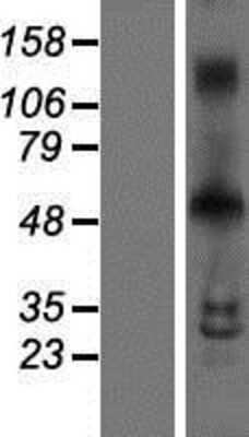 Western Blot: INSM1 Overexpression Lysate [NBP2-08139]