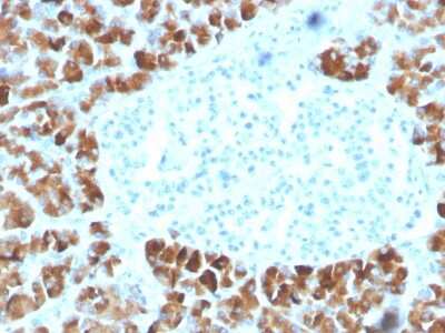 Immunohistochemistry-Paraffin: INSM2 Antibody (INSM2/4291) [NBP3-07402]