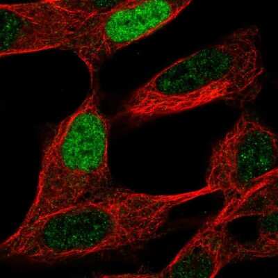 Immunocytochemistry/ Immunofluorescence: INSM2 Antibody [NBP2-55336]