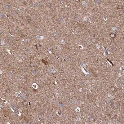 Immunohistochemistry-Paraffin: INSM2 Antibody [NBP1-81626]