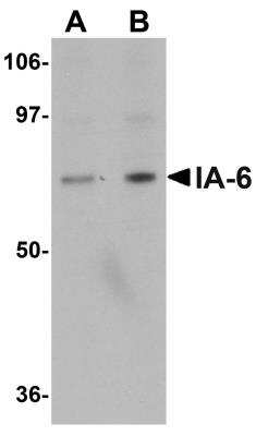 Western Blot: INSM2 AntibodyBSA Free [NBP1-76280]
