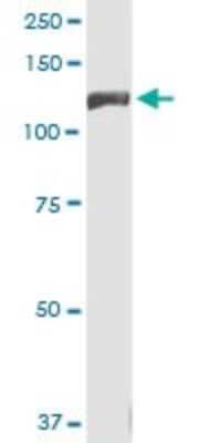 Western Blot: INSRR/IR-related receptor Antibody (5C6) [H00003645-M02]