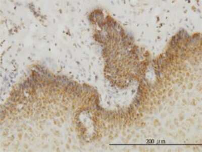 Immunohistochemistry-Paraffin: INSRR/IR-related receptor Antibody (6E6) [H00003645-M01]