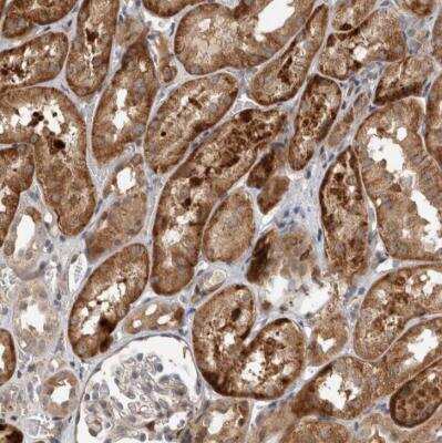 Immunohistochemistry-Paraffin: INSRR/IR-related receptor Antibody [NBP1-87704]