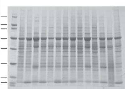 Western Blot: INSTA-Blot Breast Tissue OncoPair [NBP2-30125]