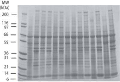 SDS-PAGE: INSTA-Blot Colon Tissue OncoPair [NBP2-30129]