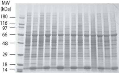 Western Blot: INSTA-Blot Female Lung Tissue OncoPair [NBP2-30123]