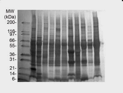 Western Blot: INSTA-Blot Human Tissues [NBP2-31378]