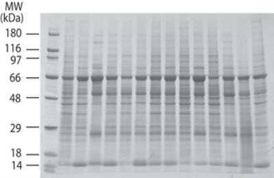 Western Blot: INSTA-Blot Male Lung Tissue OncoPair [NBP2-30122]