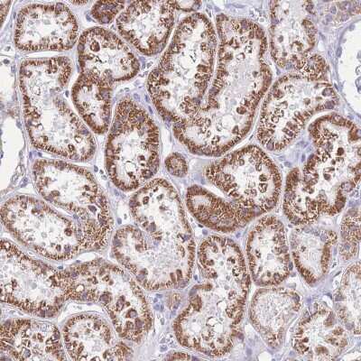 Immunohistochemistry-Paraffin: INT2 Antibody [NBP2-14125]