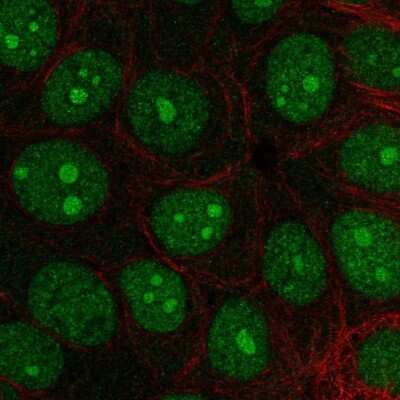 Immunocytochemistry/ Immunofluorescence: INT3 Antibody [NBP2-57633]